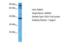 HADHA Antibody, Novus Biologicals 100 &mu;L; Unconjugated:Antibodies, Polyclonal
